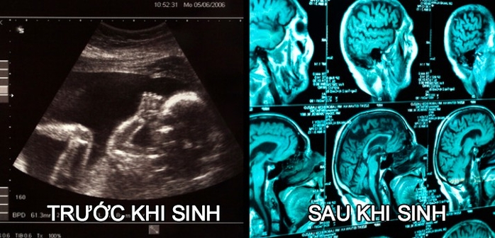 Những thay đổi tuyệt vời sau sinh
