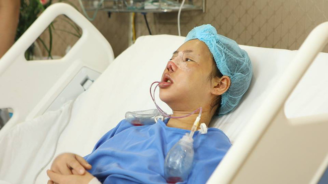 Cô giáo trẻ từng gặp tai nạn biến dạng khuôn mặt đã “lột xác” bất ngờ