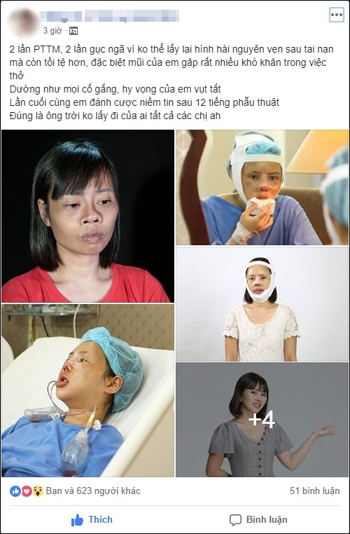 Cô giáo trẻ từng gặp tai nạn biến dạng khuôn mặt đã “lột xác” bất ngờ