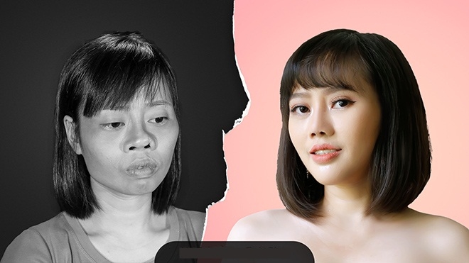 Cô giáo trẻ từng gặp tai nạn biến dạng khuôn mặt đã “lột xác” bất ngờ