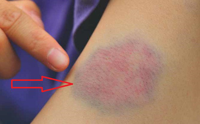 Những dấu hiệu cảnh báo cơ thể bạn đang rệu rạo, lão hóa sớm