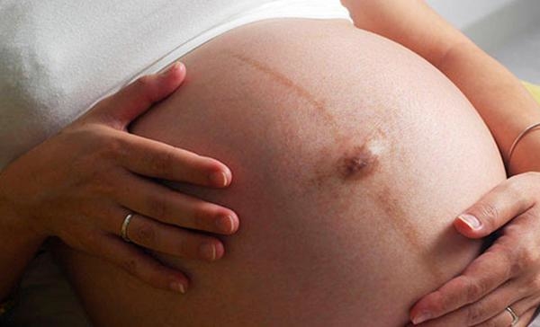 Mẹ bầu cầu cứu cộng đồng mạng vì ngứa tay nghịch dại làm rốn lồi 1 cục
