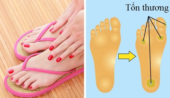 Những đôi giày phụ nữ mang thường xuyên nhưng chứa nhiều tác hại