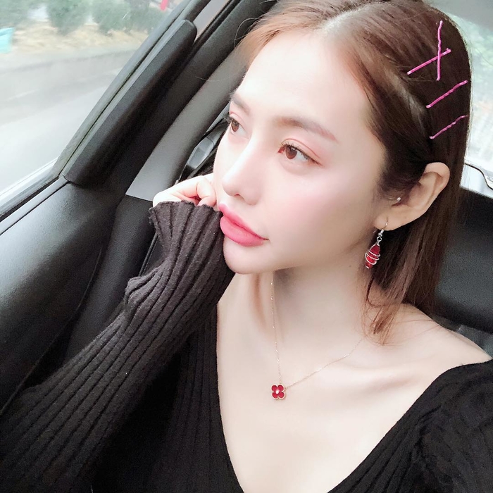 Vợ cũ - tình mới của Lâm Vinh Hải, ai dao kéo thành công hơn?
