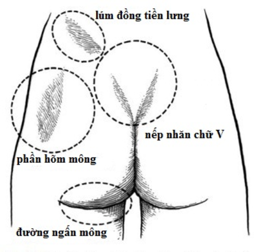 Vòng ba các nàng được gọi chuẩn và đẹp phải có các tiêu chuẩn nào?
