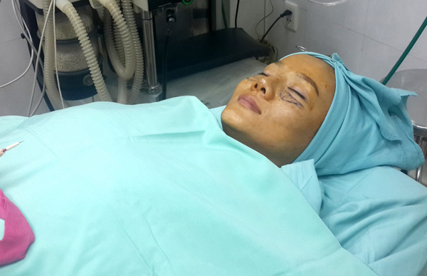 Loạt sao Việt vẫn tự tin khoe nhan sắc dù đẹp nhờ PTTM