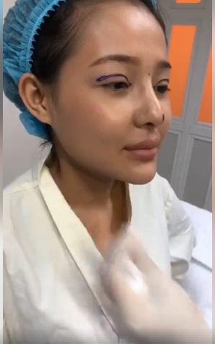 Loạt sao Việt vẫn tự tin khoe nhan sắc dù đẹp nhờ PTTM
