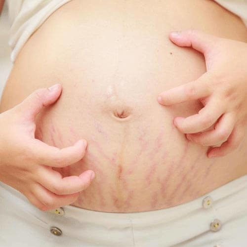 Những nổi khổ mẹ bầu phải chịu