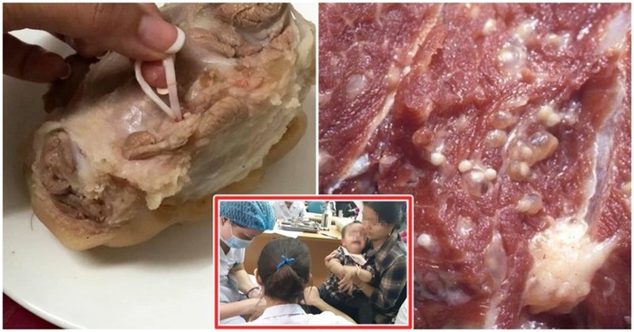 Cách tiêu diệt sán siêu đơn giản chỉ trong 2 phút dù ở thịt, cá hay ra
