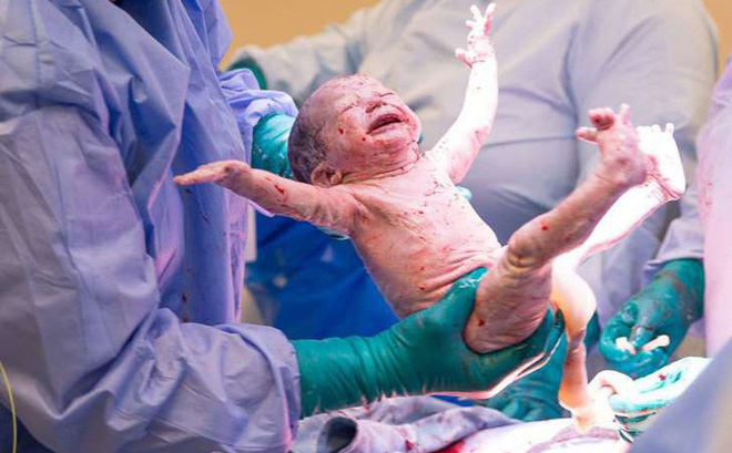 Đáng yêu khoảnh khắc bé trai chào đời giơ tay giải cứu thế giới