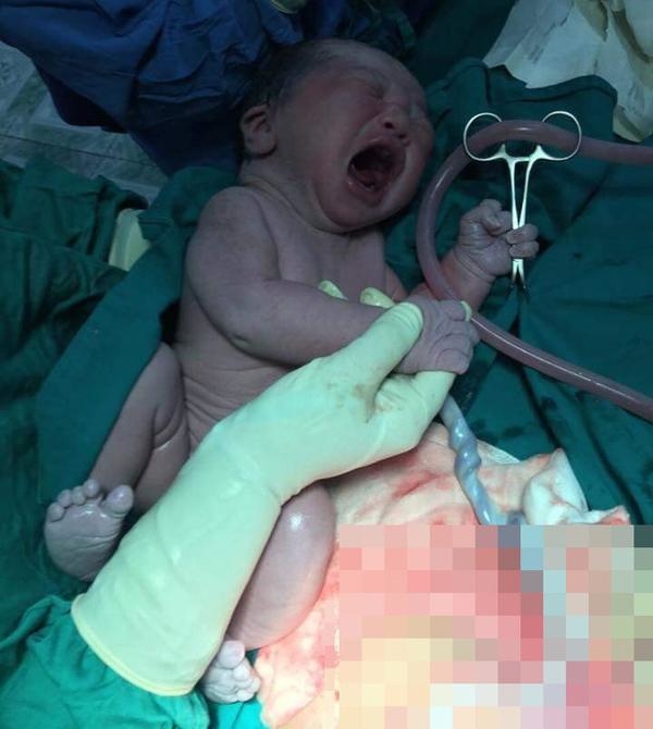 Đáng yêu khoảnh khắc bé trai chào đời giơ tay giải cứu thế giới