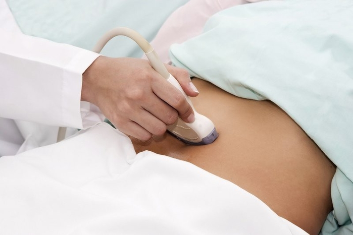 Đau bụng dữ dội cô gái trẻ tá hỏa khi biết bị xoắn buồng trứng