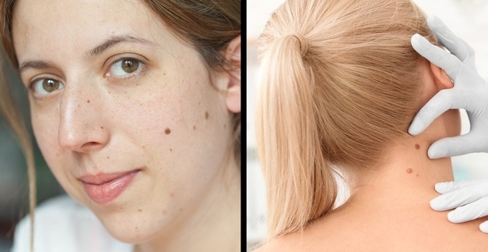 Hạn chế những thói quen làm đẹp này, kẻo hối hận khi về già