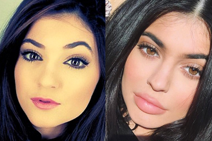 Kylie Jenner- nữ tỷ phú tự thân trẻ nhất mọi thời đại