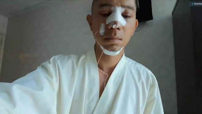 Loạt sao nam châu Á phẫu thuật thẩm mỹ