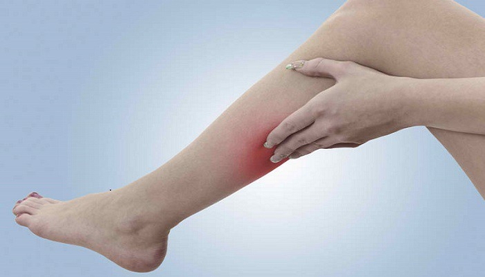 Nam Em lại khiến CĐM xôn xao và tìm hiểu về căn bệnh máu dễ đông