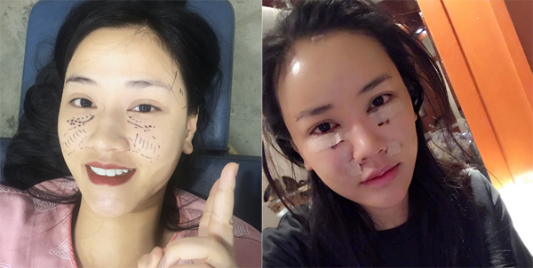Loạt sao Việt vẫn tự tin khoe nhan sắc dù đẹp nhờ PTTM
