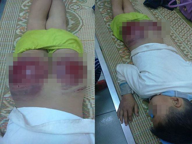 7 bộ phận nguyên hiểm trên cơ thể trẻ bố mẹ không được đánh