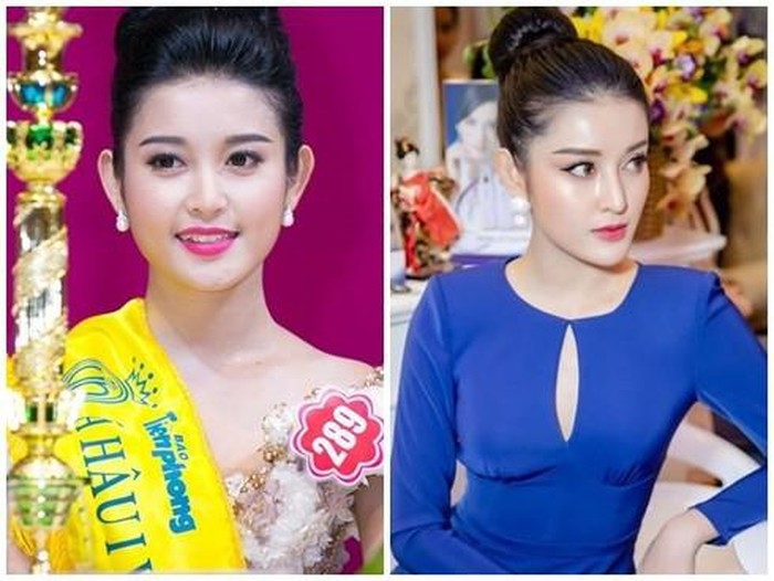 Phẫu thuật thẩm mỹ đang trở thành trào lưu đối với sao Việt?