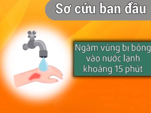 Những cách xử lí kịp thời khi bé bị bỏng mà ba mẹ cần khắc cốt ghi tâm Những cách xử lí kịp thời khi bé bị bỏng mà ba mẹ cần khắc cốt ghi tâm