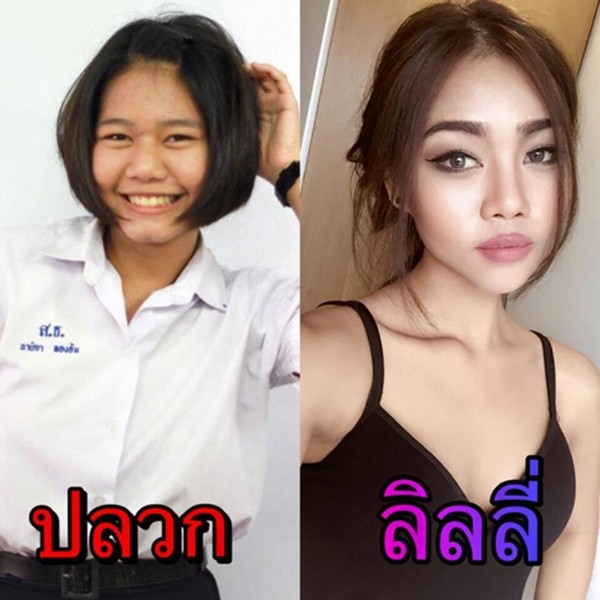 Hot girl bốc lửa Thái Lan bất ngờ công khai ảnh phẫu thuật để có eo con kiến, điều đáng nói đây không phải lần đầu cô lột xác - Ảnh 3.