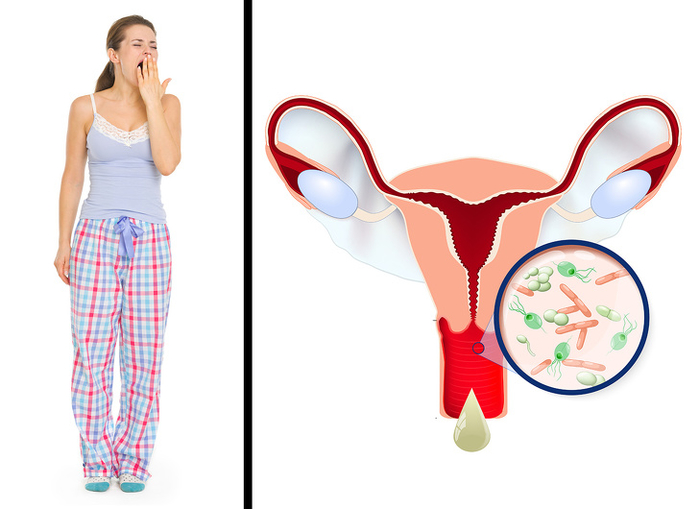8 loại trang phục quá nguy hiểm nếu bạn mặc thường xuyên