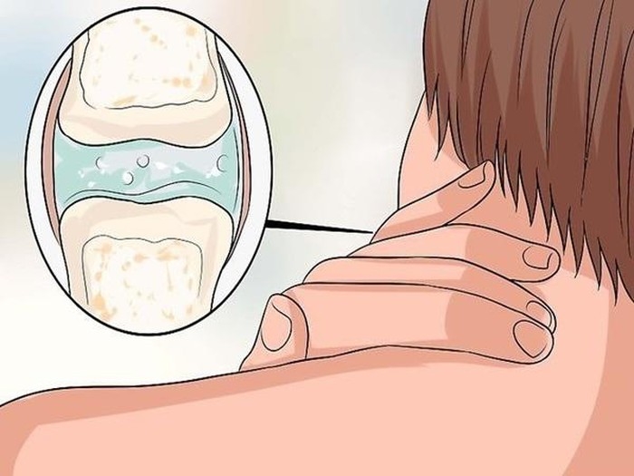 Cô gái 23 tuổi liệt nửa người vì một hành động đơn giản