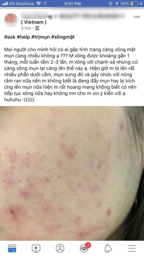Cô gái trẻ “rước mụn lên mặt” vì lạm dụng việc xông mặt bằng chanh sả