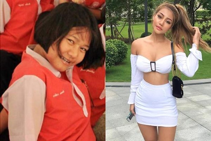 Hot girl bốc lửa Thái Lan bất ngờ công khai ảnh phẫu thuật 
