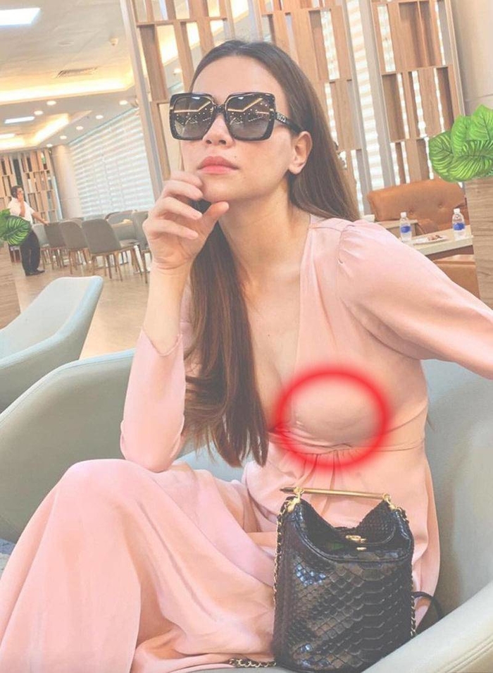 Lộ miếng dán ngực “kém sang”, cách nào để không mắc phải sự cố?