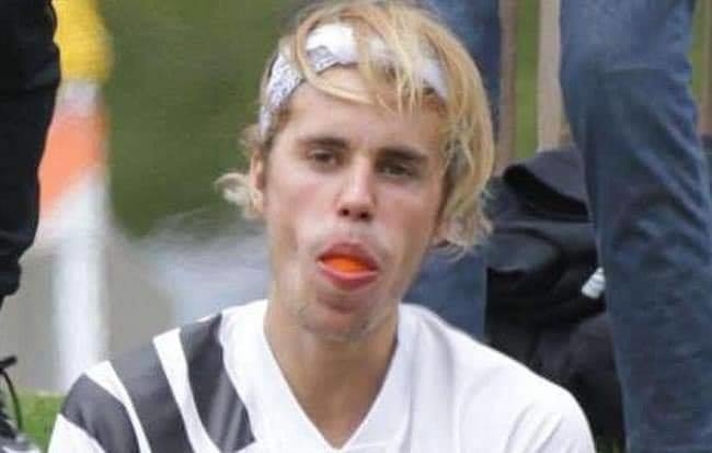 Ngoại hình xuống cấp của siêu sao quốc tế Justin Bieber