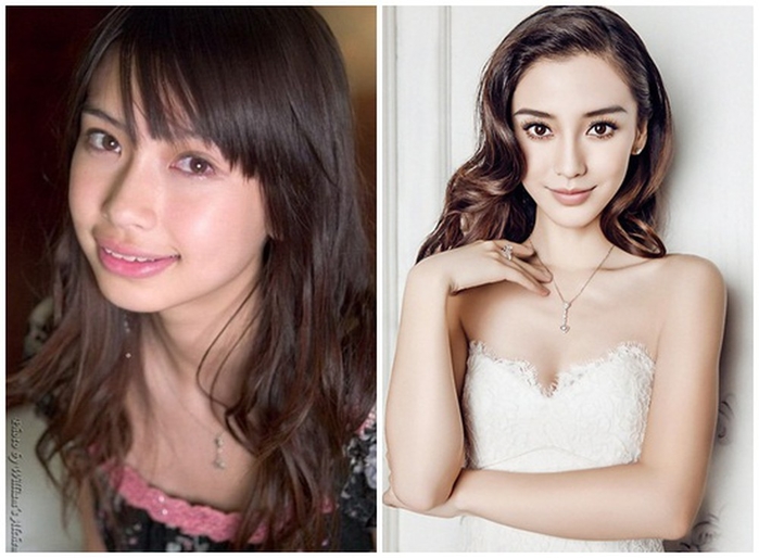 Những cặp vợ chồng dao kéo cả đôi của showbiz Châu Á