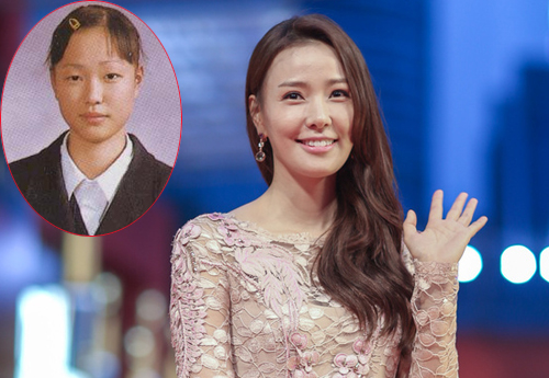 Những cặp vợ chồng dao kéo cả đôi của showbiz Châu Á