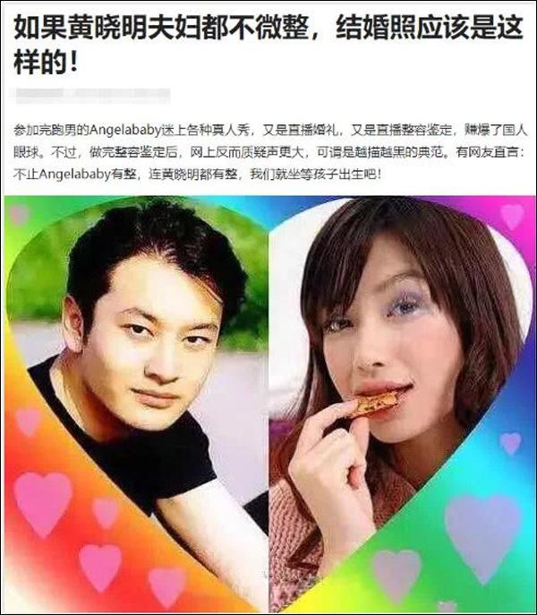 Những cặp vợ chồng dao kéo cả đôi của showbiz Châu Á