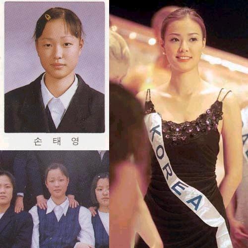 Những cặp vợ chồng dao kéo cả đôi của showbiz Châu Á
