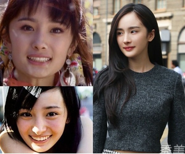 Những cặp vợ chồng dao kéo cả đôi của showbiz Châu Á