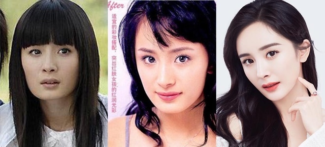 Những cặp vợ chồng dao kéo cả đôi của showbiz Châu Á