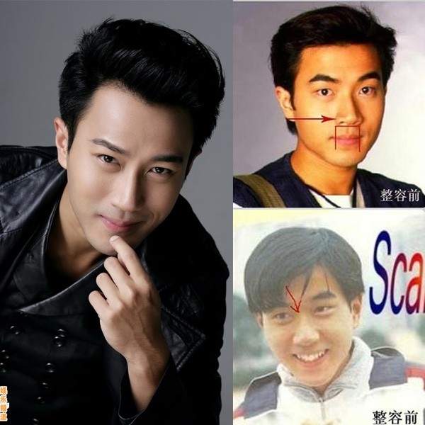 Những cặp vợ chồng dao kéo cả đôi của showbiz Châu Á