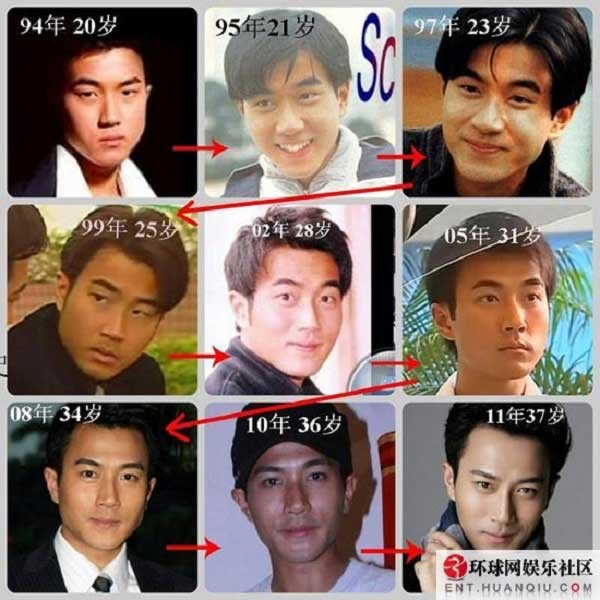 Những cặp vợ chồng dao kéo cả đôi của showbiz Châu Á