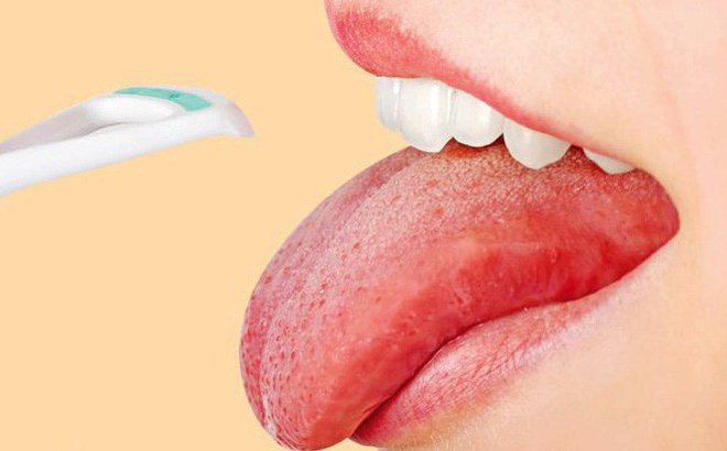 Những dấu hiệu nhỏ trên cơ thể cảnh báo những căn bệnh nghiêm trọng