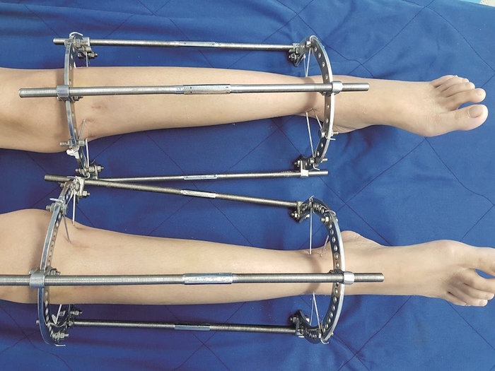 Những kiểu phẫu thuật thẩm mỹ đến bác sĩ cũng phải chùn tay