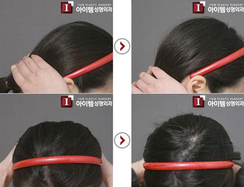 Những kiểu phẫu thuật thẩm mỹ đến bác sĩ cũng phải chùn tay
