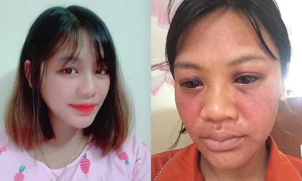 Hình ảnh trước và sau khi sinh của chị Kim Oanh