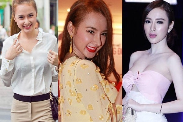 Sao Việt và hành trình tìm lại nhan sắc sau PTTM hỏng