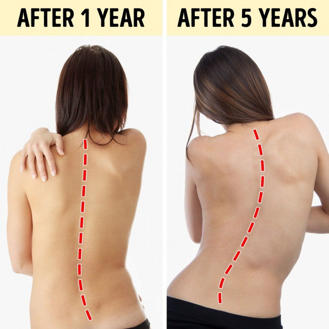 10 tác hại nghiêm trọng cho sức khỏe nếu ngồi một chỗ 8 tiếng mỗi ngày