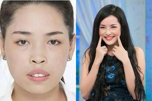 Những ca niềng răng giúp nhiều người lột xác