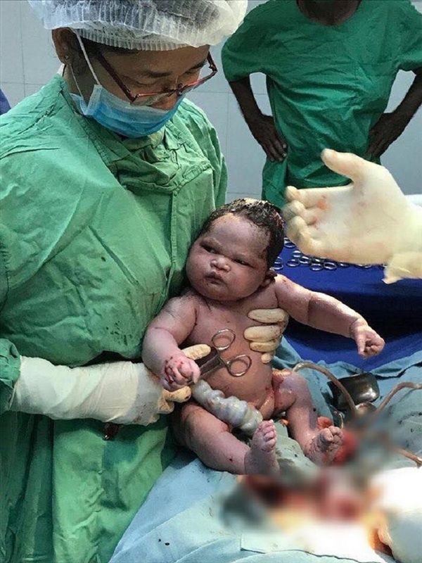 Biểu cảm siêu dễ thương của trẻ sơ sinh khi chào đời
