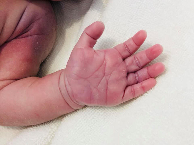 Bất chấp nguy hiểm sinh con thứ 3, Hải Băng vừa hạ sinh quý tử