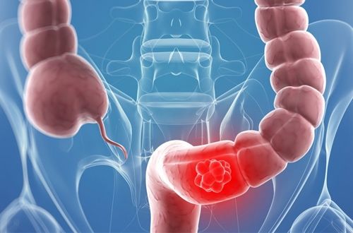 Ca sĩ Vương Bảo Tuấn qua đời ở tuổi 44 vì ung thư trực tràng