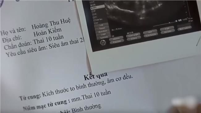 Các hạt sạn phi lý đến hài hước trong Về Nhà Đi Con
